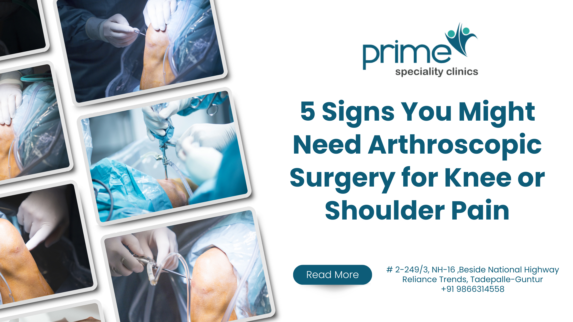 5 Signs You Might Need Arthroscopic Surgery for Knee or Shoulder Pain